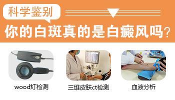 小女孩皮肤上有白斑怎么办